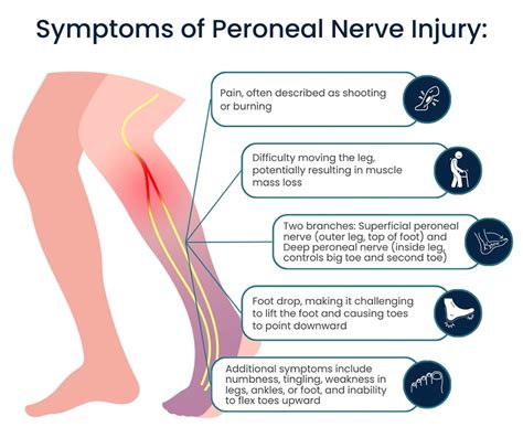 Peroneal Nerve Treatment in NYC | Pain Management NYC