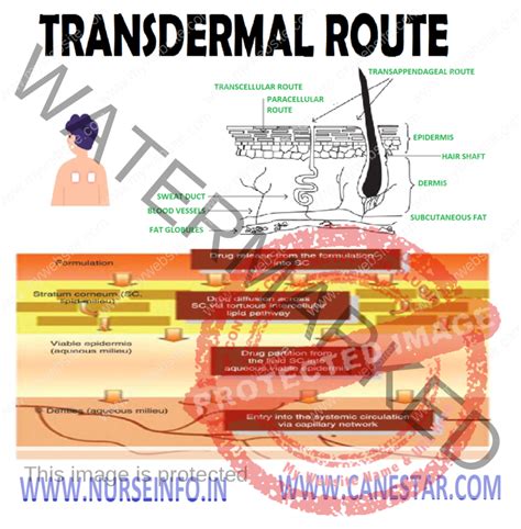 TRANSDERMAL ROUTE OF DRUG ADMINISTRATION - Nurse Info