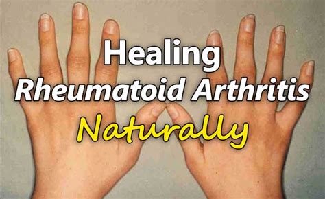 How Haley Love Was Able To Heal Rheumatoid Arthritis & Fibromyalgia After Her Long Journey