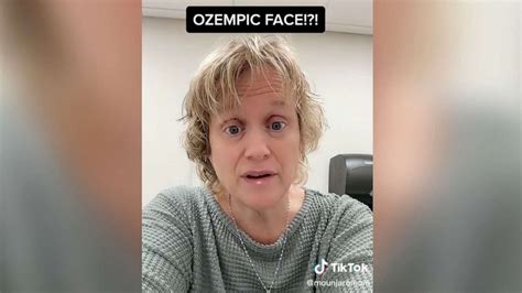 What to know about 'Ozempic face' as some users claim popular diabetes drugs used for weight ...