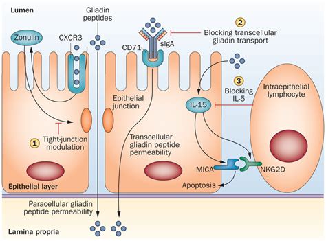 Glutalytic: Enzymatic Support for Gluten Breakdown that Minimises Exposure to Immunogenic ...