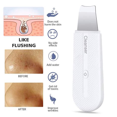 Ultrasonic Skin Scrubber Ion Deep Face Cleaner Blackhead Remover Face ...