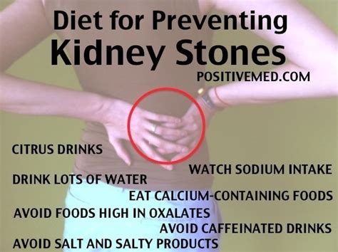 Diet for Preventing Kidney Stones