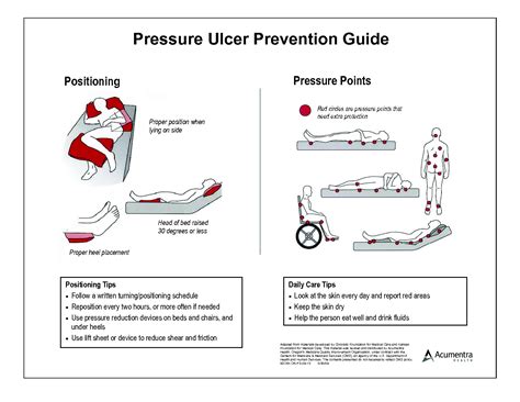 keep on turning! | Pressure ulcer, Bed sores, Ulcers