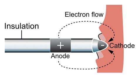 Components and construction of a pacemaker – Cardiovascular Education