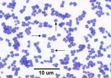 Micrococcus luteus - Alchetron, The Free Social Encyclopedia