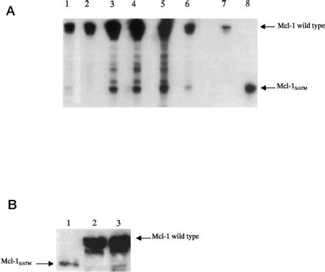 Endogenous Mcl-1 s/TM is expressed at low levels relative to... | Download Scientific Diagram