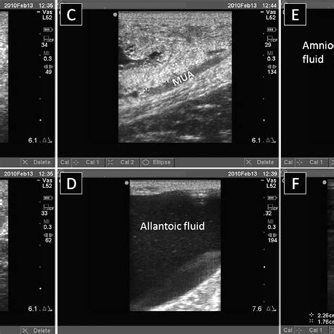 Ultrasonographic images taken during transrectal examination of a ...