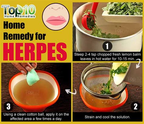 Home Remedies for Herpes | Top 10 Home Remedies