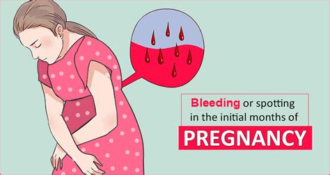 Causes and warning of Bleeding or Spotting in the Initial Months of Pregnancy