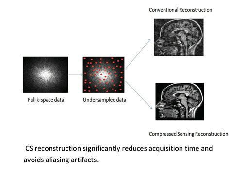 Compressed Sensing for Rapid MRI: Need for Speed - LATEST BIOMEDICAL ...