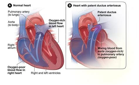 What is the Definition of Congenital Heart Disease in Adults and Children?