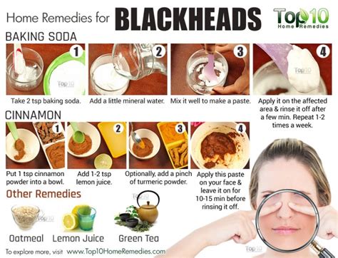 Home Remedies to Get Rid of Blackheads Fast | Top 10 Home Remedies