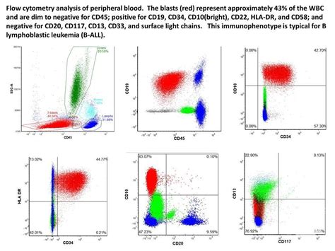 B cell ALL flow cytometry