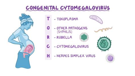 Congenital cytomegalovirus (NORD): Video & Anatomy | Osmosis