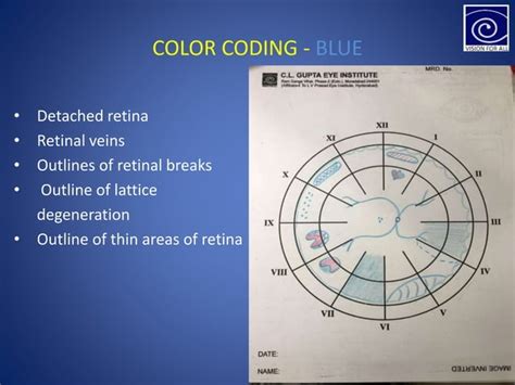 Indirect ophthalmoscopy and fundus drawing | PPT