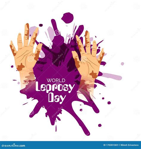 World Leprosy Day Poster Vector Illustration | CartoonDealer.com #134850808