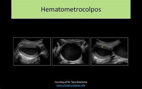 OB GYN Ultrasound Registry Review