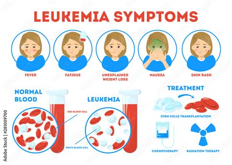 Leukemia symptoms infographic concept. Dangerous disease, treatment ...