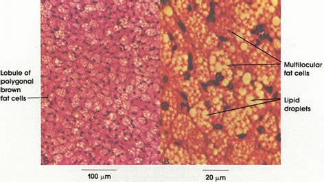 kilian palacio: of brown fat cells reveal