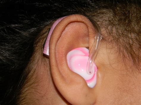 Raising a hearing impaired child: our journey: New Molds!