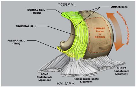 Scapholunate Ligament of the Wrist and Rehabilitation | Carpal Instability - ReHand ...