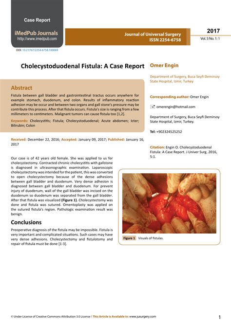 (PDF) Cholecystoduodenal Fistula: A Case Report