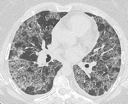 Critical Care Quick Hits