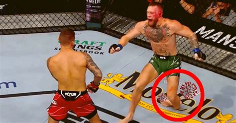 Fauci: Conor McGregor ankle injury caused by COVID; vaccine would have ...