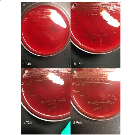 Colonies of pure Helcococcus ovis on Columbia agar plates supplemented... | Download Scientific ...