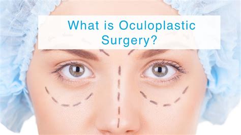 Oculoplastic Surgery | Types | Recovery Time | Cost - Sutured