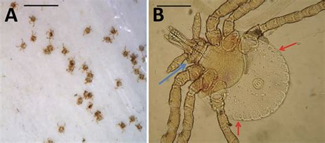 Lone Star Tick Larvae Often Mistaken for 'Chiggers' on the East End