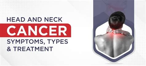 Head and Neck Cancer: Symptoms, Types & Treatment