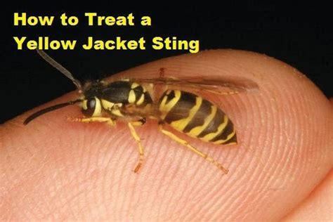 How to Treat a Yellow Jacket Sting | Articles on Health