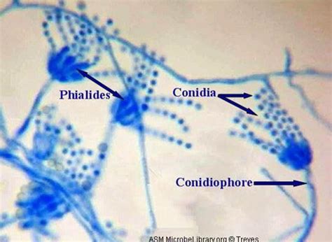 Terminology Related to Morphologic Features of Molds | Medical Laboratories