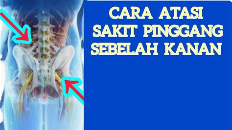 CARA ATASI SAKIT PINGGANG SEBELAH KANAN - YouTube