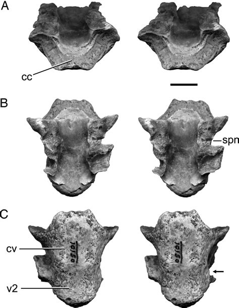 Beelzebufo ampinga, holotype, fused cervical and second presacral... | Download Scientific Diagram