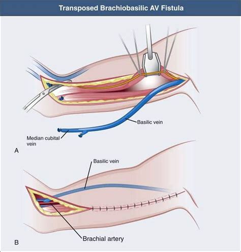 Pictures Of Basilic Vein