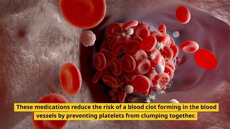 An Overview of Clopidogrel: Uses, Side Effects, and Dosing Information - YouTube