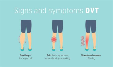 These Are The 5 Natural Ways To Deal With Deep Vein Thrombosis