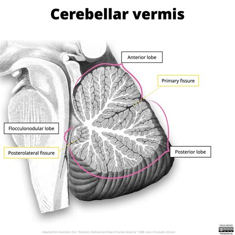 Image | Radiopaedia.org