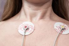 Ecg Electrodes Attached To Torso Free Stock Photo - Public Domain Pictures