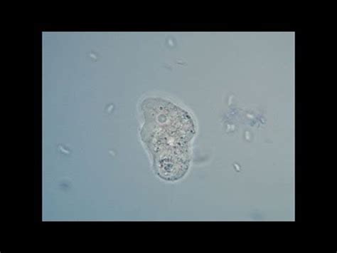 Amoebas under the microscope - 1000x magnification - YouTube