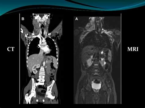 MRI vs CT | Radiology humor, Magnetic resonance imaging, Magnetic resonance