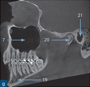 Dentoalveolar Anatomy | Pocket Dentistry