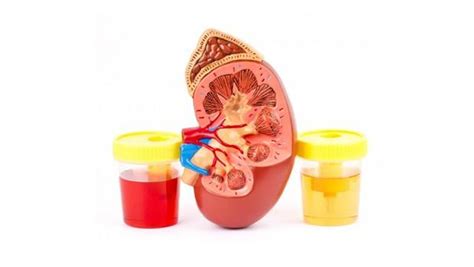 14 best home remedies for kidney pain