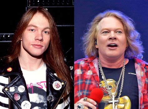 Axl Rose, Plastic Surgery, Before And After - Axl Rose Now - 1024x759 ...