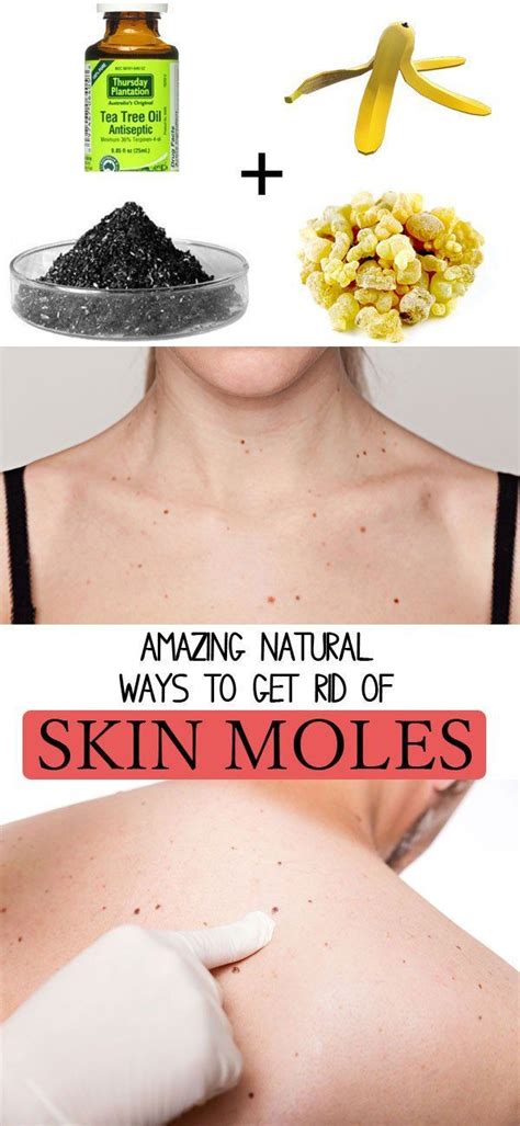 4 ingredients that help you remove moles fast and naturally - Beauty Tricks | Mole removal ...