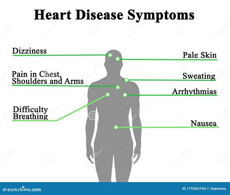 Symptoms of Heart Disease stock photo. Image of illness - 179365744