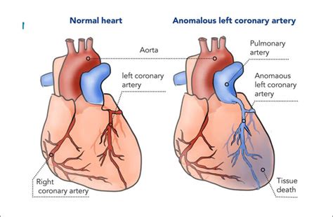 Top Heart Surgeon In India, Best Heart Surgeon In Mumbai, India